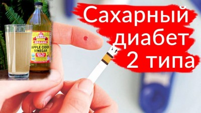 Сахарный диабет 2 типа (инсулин-резистентность)