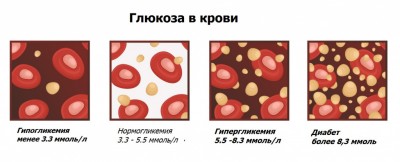 Глюкоза (в крови) Показания к назначению