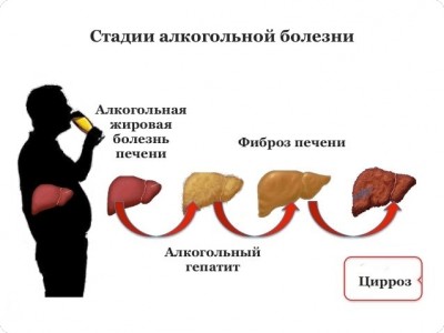 Алкогольная болезнь печени (алкогольный гепатит)это поражение печени, вызванное употреблением избыточного количества а Диагностика и лечение