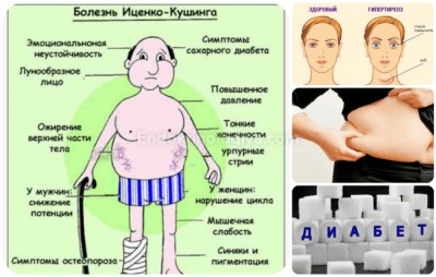 Что такое кортизол,важно знать.