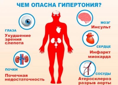 Высокое давление: причины и лечение