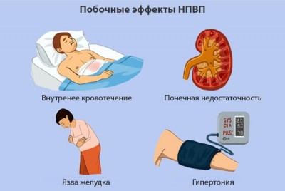 Противовоспалительные средства (НПВС) подробнее