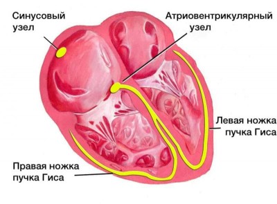 Синдром слабости синусового узла
