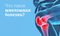 Миелома: причины, стадии, симптомы, лечение